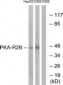 PRKAR2B Antibody (aa79-128)
